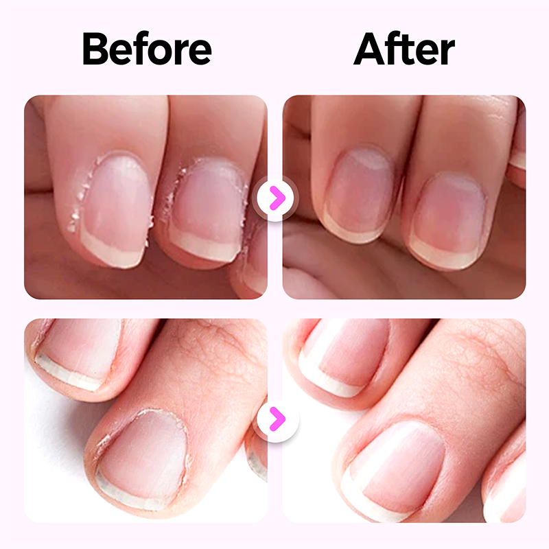 1+1 FREE | MagicNails – Care, Fragrance & Shine in just 1 Pen