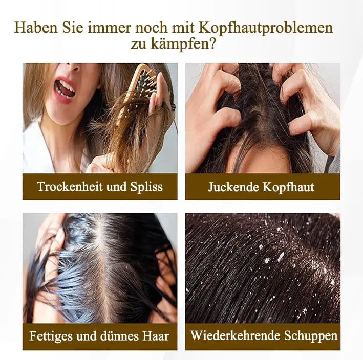 PureScalp – Finally Say Goodbye to Dandruff & Itching!