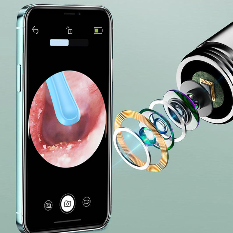 Audiora – Remove Earwax Safely with Live HD Camera Guide