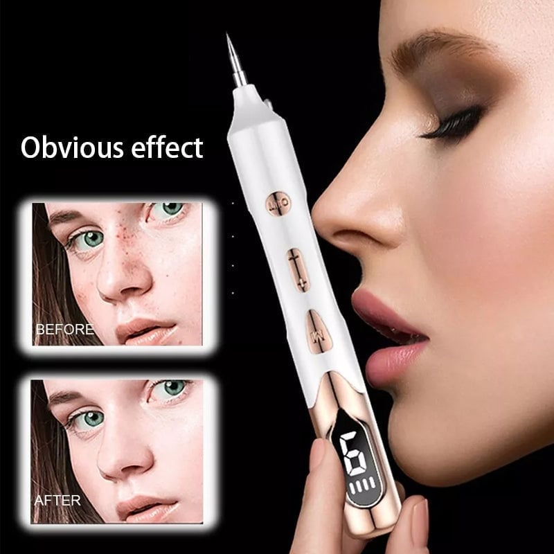 UltraGlow - Quickly removes moles and spots for flawless skin