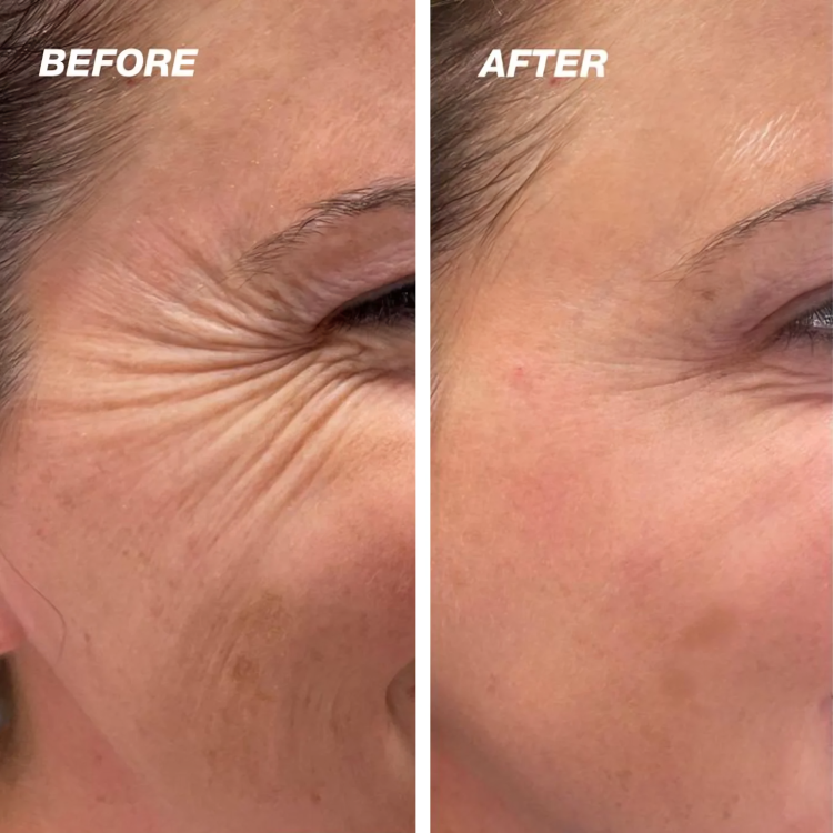 1+1 FREE | DermCare SkinGlow – For flawlessly smooth skin!