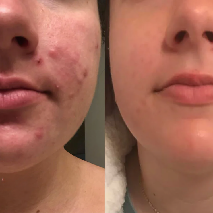 1+1 FREE | DermCare SkinGlow – For flawlessly smooth skin!