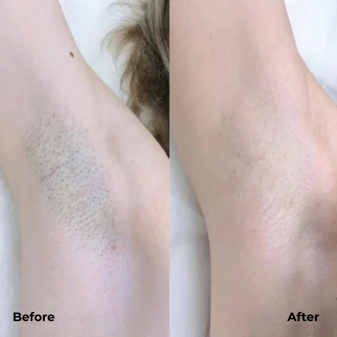 SilkGlide – Fast, Gentle Shaving Without Cuts or Irritations