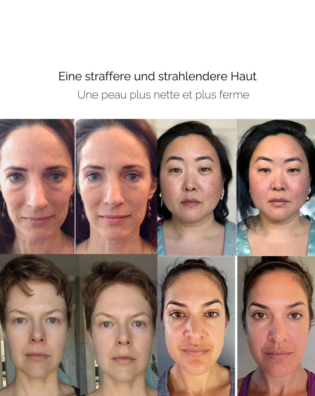 SilkSkin – Smooths wrinkles and tightens skin quickly