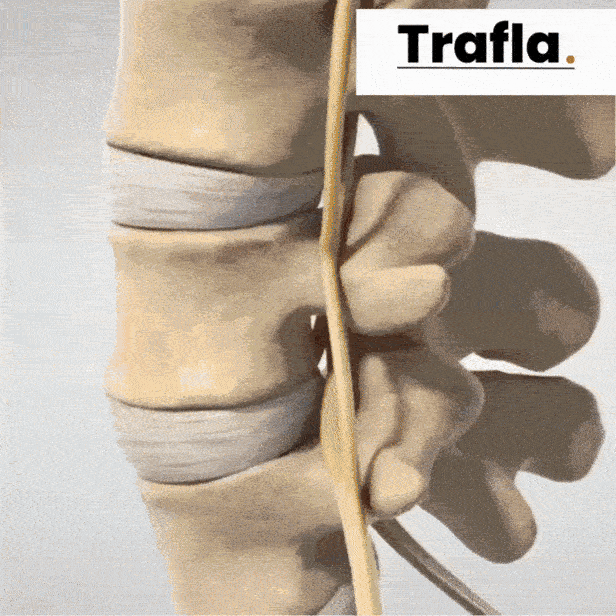 SpineBelt – Move Pain-Free, Live Upright Again