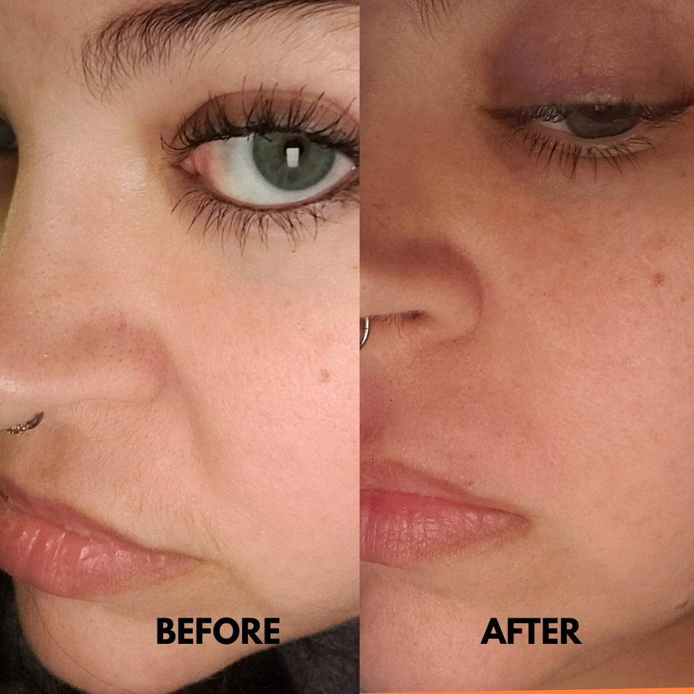 SilkRooter – Gentle, Irritation-Free Facial Hair Removal with Long-Lasting Results