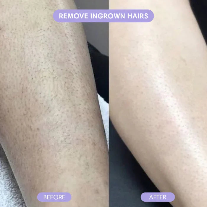 SilkGlide – Fast, Gentle Shaving Without Cuts or Irritations